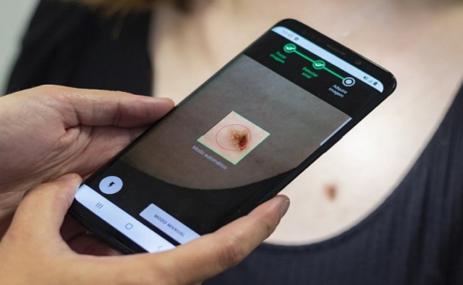 Doctors can now predict skin cancer severity using AI